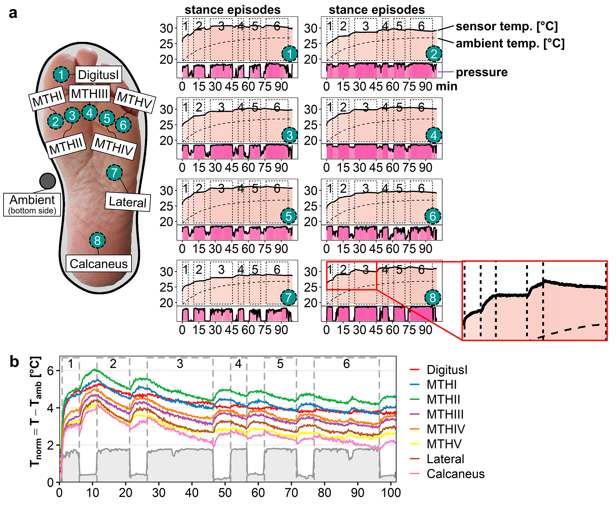 Compound figure illustrating temperature changes recorded by sensor-equipped insole for an example subject during the study experiment. 